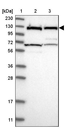 Lane 1: Marker [kDa] 230, 130, 95, 72, 56, 36, 28, 17, 11<br/>Lane 2: Human cell line RT-4<br/>Lane 3: Human cell line U-251MG sp