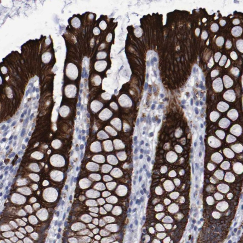 Immunohistochemical staining of human rectum shows strong cytoplasmic positivity in glandular cells.