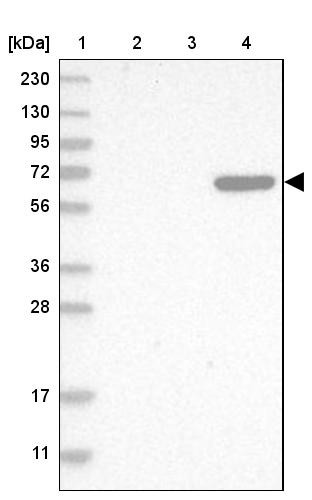 Lane 1: Marker [kDa] 230, 130, 95, 72, 56, 36, 28, 17, 11<br/>Lane 2: Human cell line RT-4<br/>Lane 3: Human cell line U-251MG sp<br/>Lane 4: Human plasma (IgG/HSA depleted)