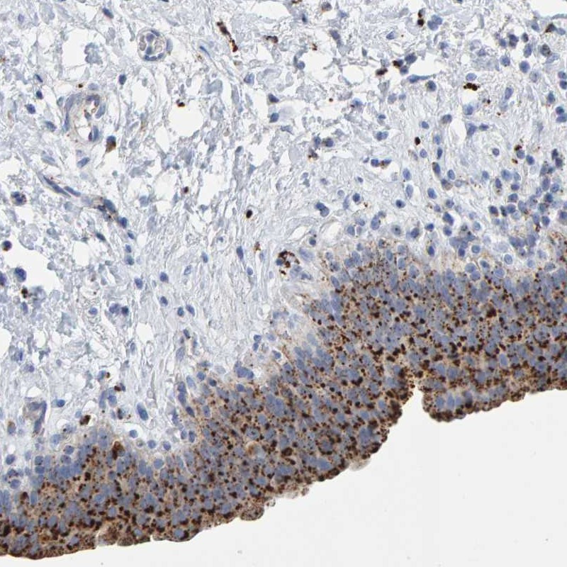 Immunohistochemical staining of human urinary bladder shows strong granular cytoplasmic positivity in urothelial cells.