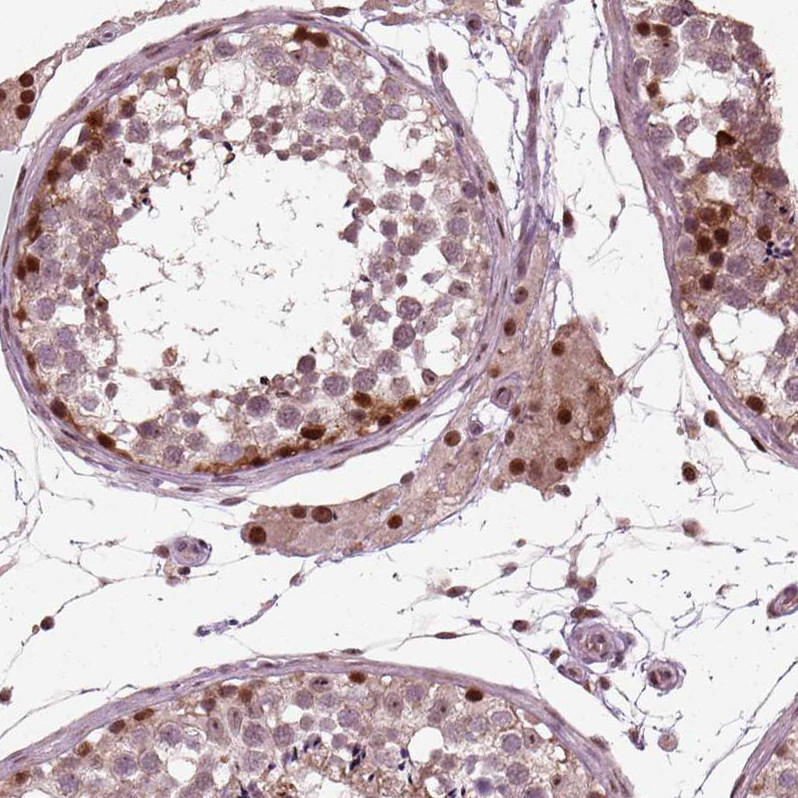 Immunohistochemical staining of human testis shows strong nuclear positivity in cells in seminiferous ducts.