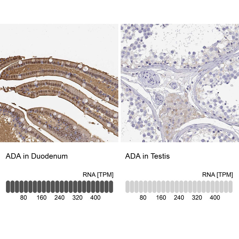 Immunohistochemistry analysis in human duodenum and testis tissues using HPA023884 antibody. Corresponding ADA RNA-seq data are presented for the same tissues.