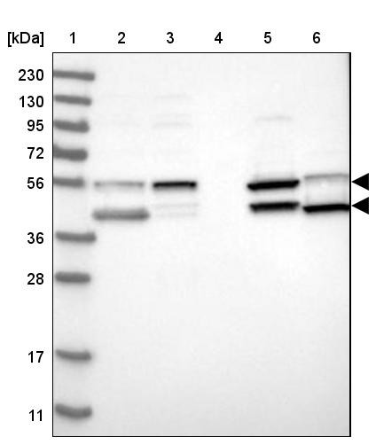 Lane 1: Marker [kDa] 230, 130, 95, 72, 56, 36, 28, 17, 11<br/>Lane 2: Human cell line RT-4<br/>Lane 3: Human cell line U-251MG sp<br/>Lane 4: Human plasma (IgG/HSA depleted)<br/>Lane 5: Human liver tissue<br/>Lane 6: Human tonsil tissue