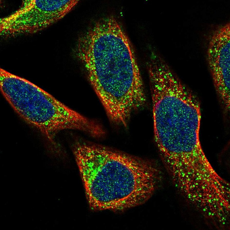 Immunofluorescent staining of human cell line U-2 OS shows localization to vesicles.