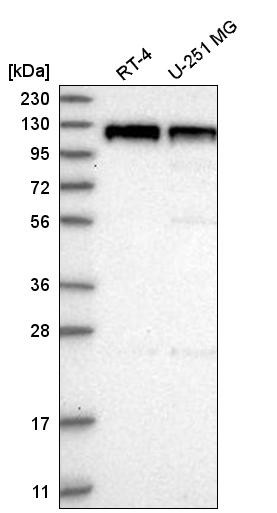Western blot analysis in human cell line RT-4 and human cell line U-251 MG.