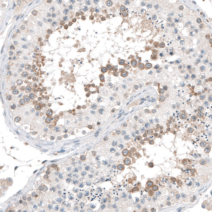 Immunohistochemical staining of human testis shows cytoplasmic positivity in cells in seminiferous ducts.