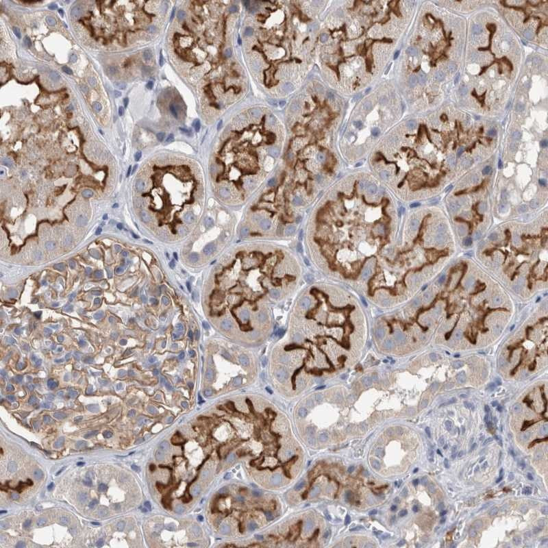 Immunohistochemical staining of human kidney shows distinct membranous positivity in tubular cells.