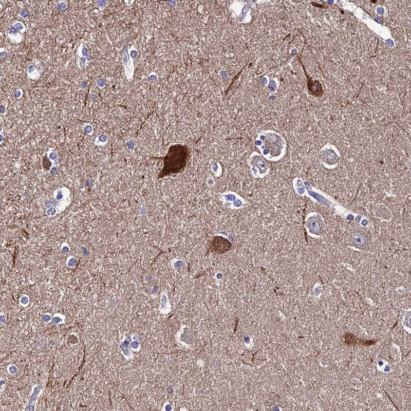 Immunohistochemical staining of human hippocampus shows strong cytoplasmic and nuclear positivity in fraction of neuronal cells.