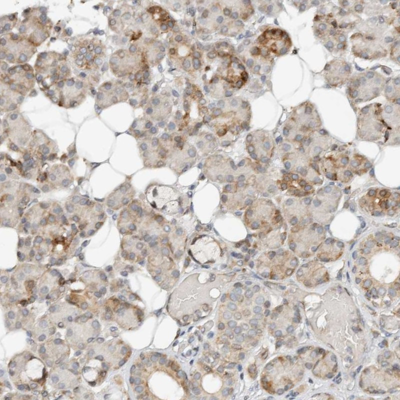 Immunohistochemical staining of human salivary gland shows moderate cytoplasmic positivity in few glandular cells.