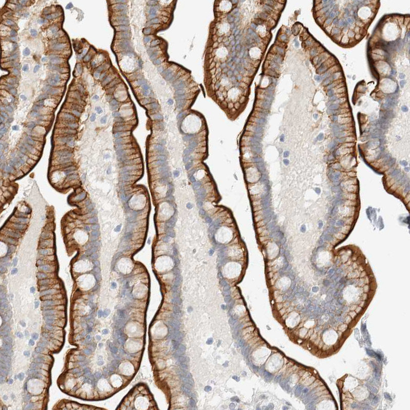 Immunohistochemical staining of human Colon shows moderate positivity in apical membrane in glandular cells.
