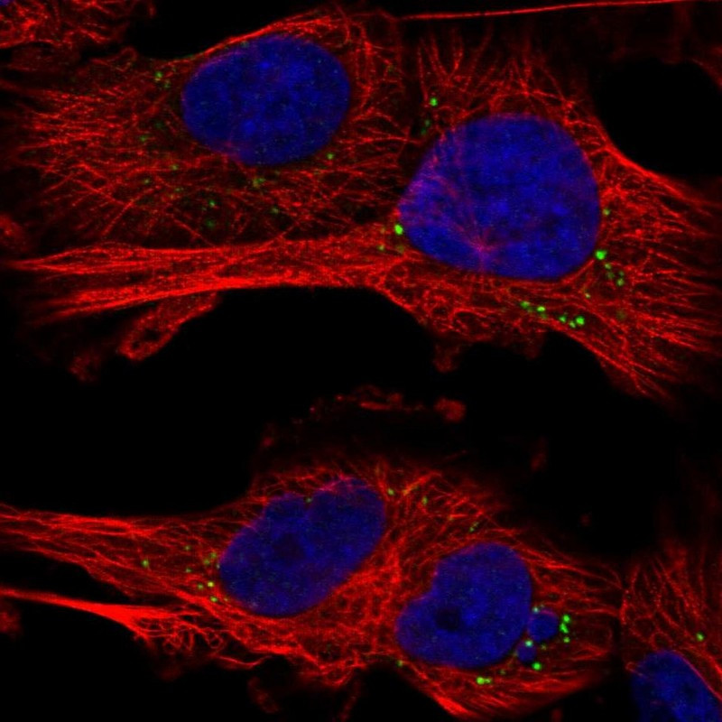 Immunofluorescent staining of human cell line U-251 MG shows localization to vesicles.