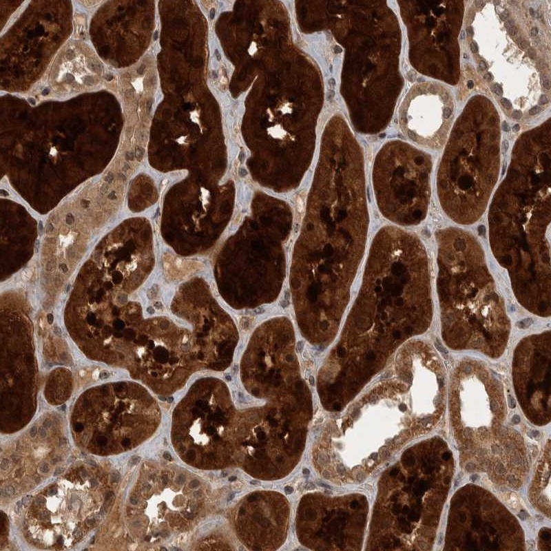 Immunohistochemical staining of human kidney shows strong cytoplasmic positivity in tubular cells.