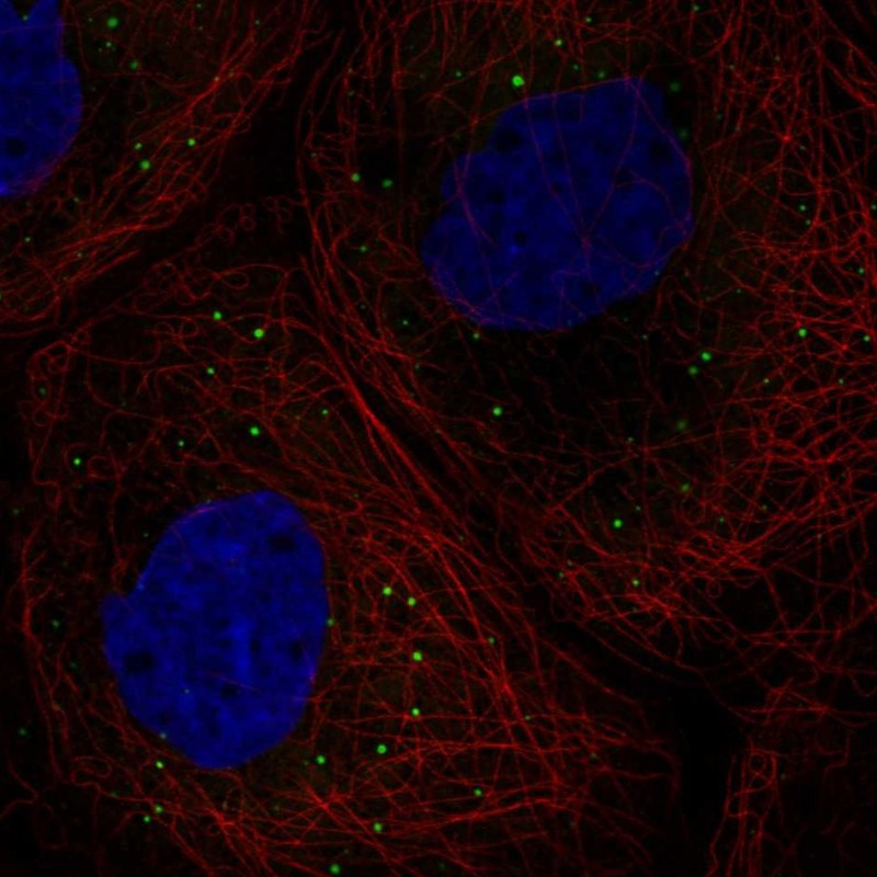Immunofluorescent staining of human cell line A-431 shows localization to cytoplasmic bodies.