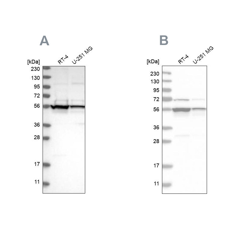 Western blot analysis using Anti-DDX6 antibody HPA024201 (A) shows similar pattern to independent antibody HPA026644 (B).