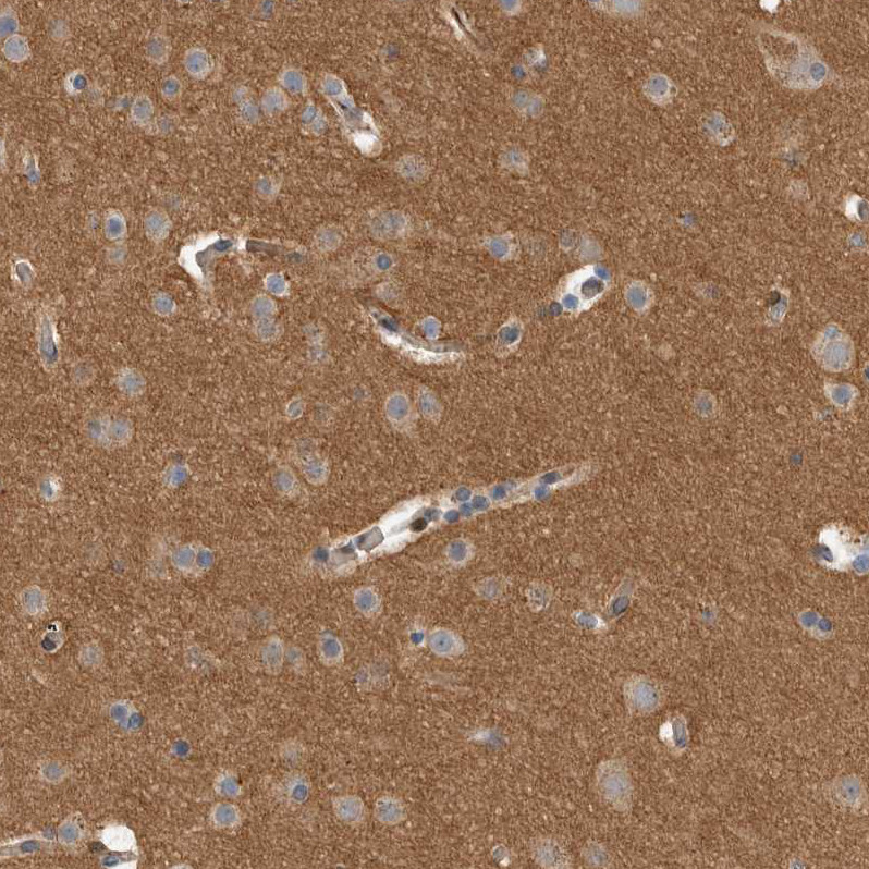 Immunohistochemical staining of human Cerebral cortex shows moderate cytoplasmic positivity in neuropil.