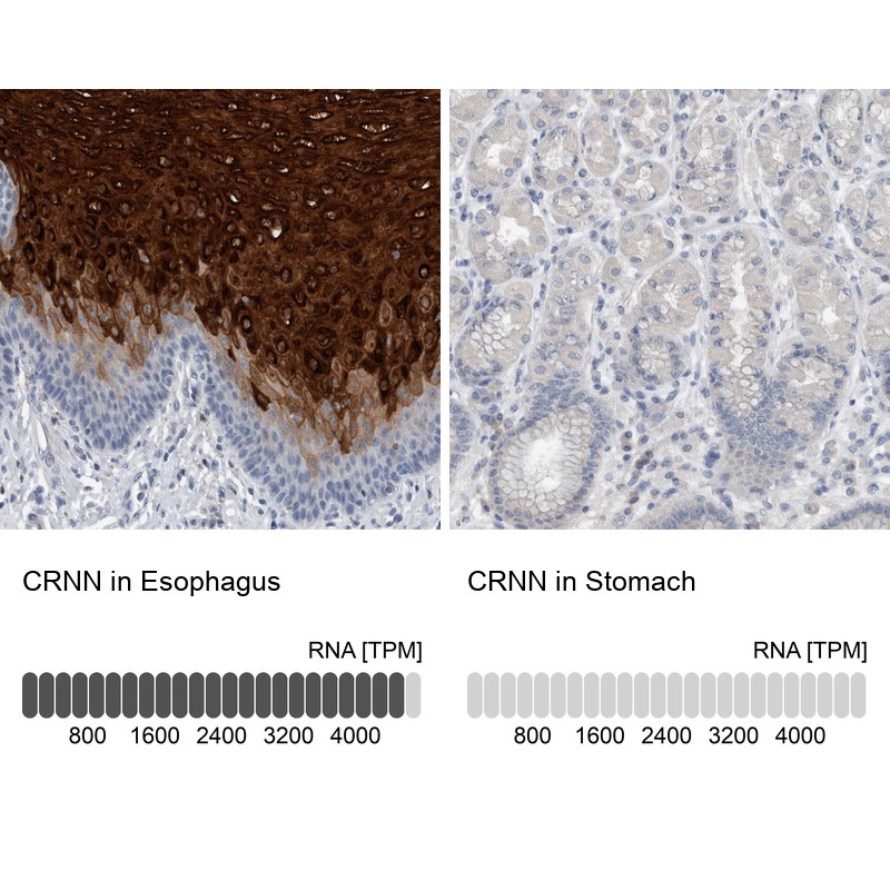 Immunohistochemistry analysis in human esophagus and stomach tissues using Anti-CRNN antibody. Corresponding CRNN RNA-seq data are presented for the same tissues.