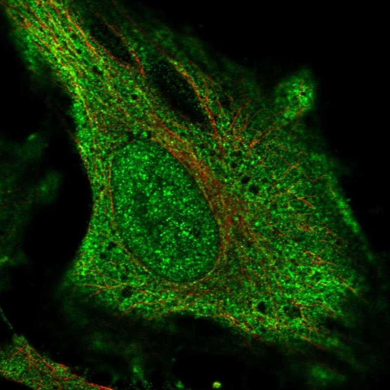 Immunofluorescent staining of human cell line HeLa shows localization to nucleoplasm & plasma membrane.