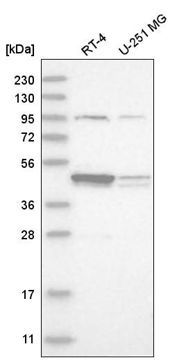 Western blot analysis in human cell line RT-4 and human cell line U-251 MG.