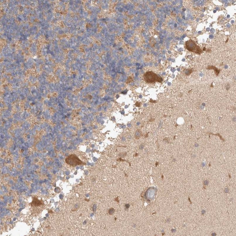 Immunohistochemical staining of human cerebellum shows strong cytoplasmic positivity in Purkinje cells.