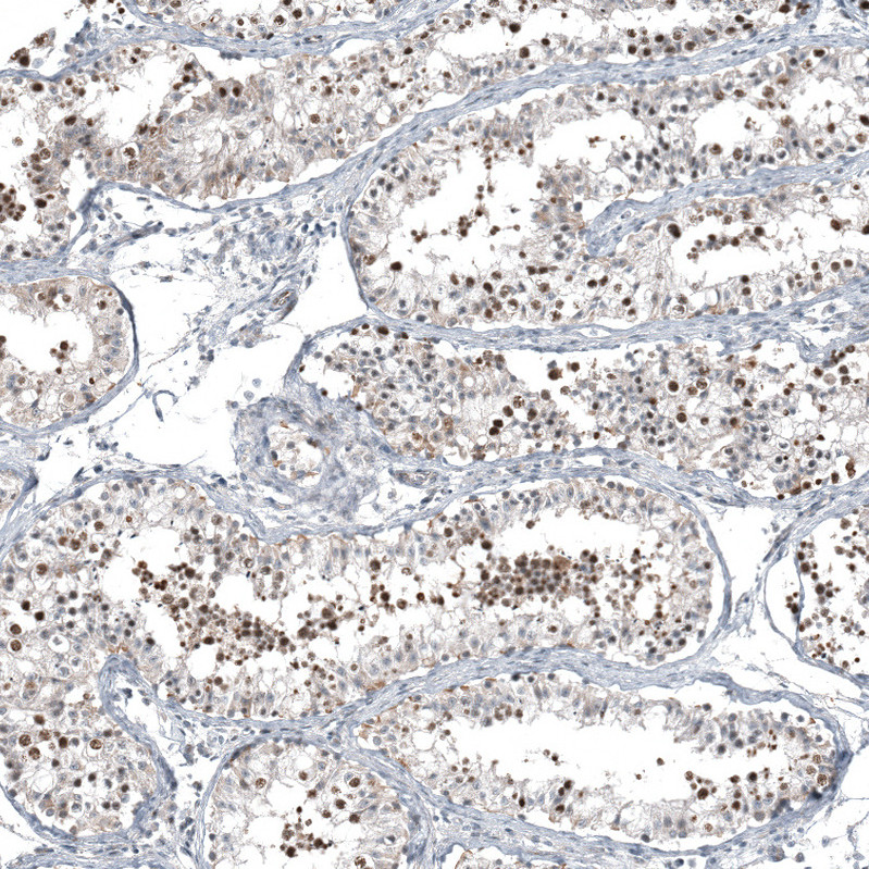 Immunohistochemical staining of human testis shows moderate nuclear positivity in cells in seminiferous ducts.