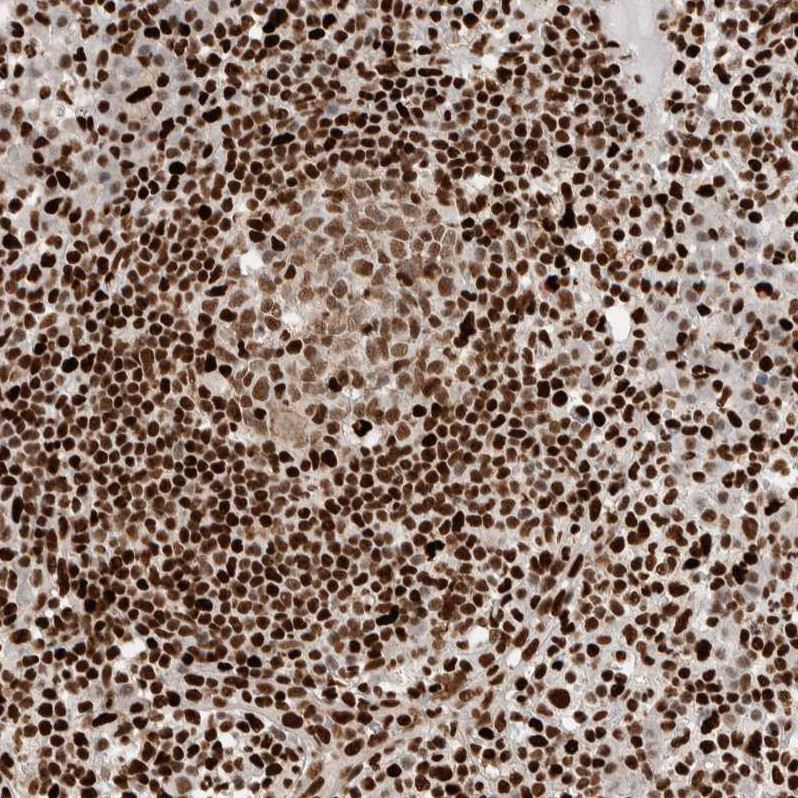 Immunohistochemical staining of human lymph node shows moderate to strong nuclear positivity in lymphoid cells.