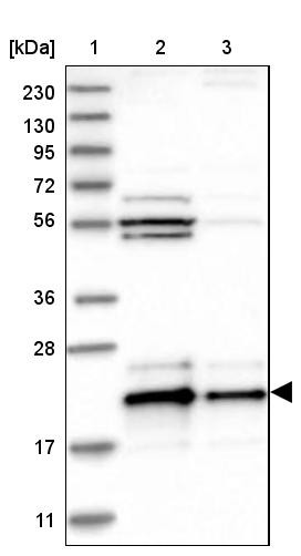 Lane 1: Marker [kDa] 230, 130, 95, 72, 56, 36, 28, 17, 11<br/>Lane 2: Human cell line RT-4<br/>Lane 3: Human cell line U-251MG sp