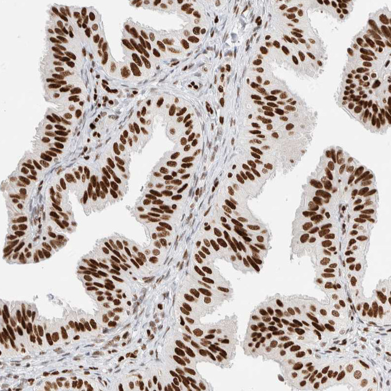 Immunohistochemical staining of human fallopian tube shows moderate to strong nuclear positivity in glandular cells.