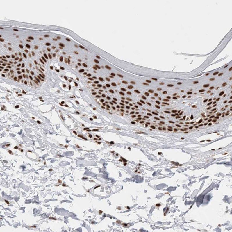 Immunohistochemical staining of human skin shows moderate to strong nuclear positivity in squamous epithelial cells.