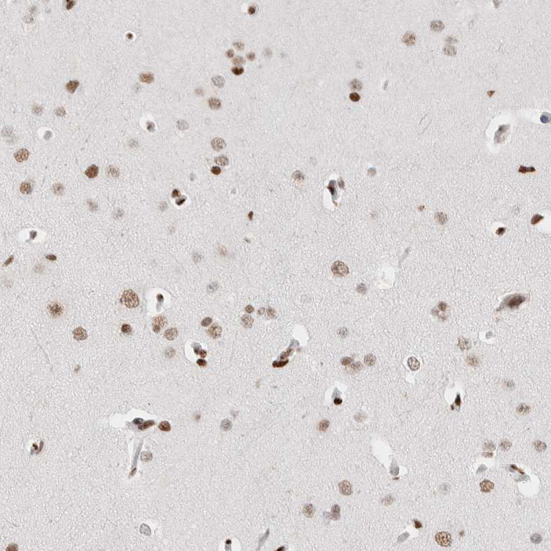Immunohistochemical staining of human cerebral cortex shows weak to moderate nuclear positivity in neurons and glial cells.