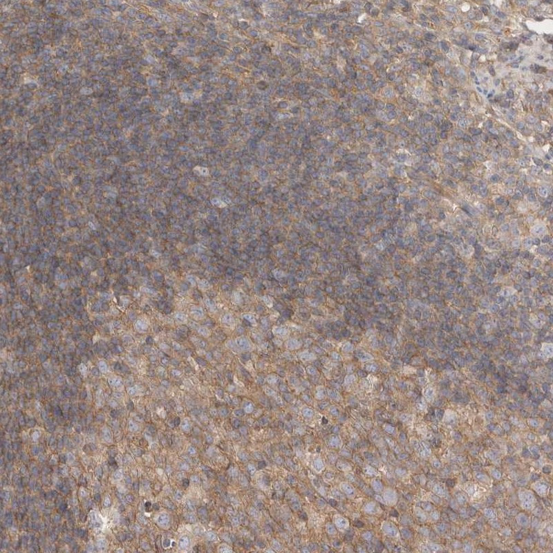 Immunohistochemical staining of human appendix shows cytoplasmic positivity in germinal center.