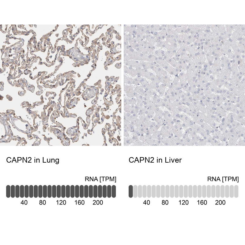 Immunohistochemistry analysis in human lung and liver tissues using HPA024470 antibody. Corresponding CAPN2 RNA-seq data are presented for the same tissues.