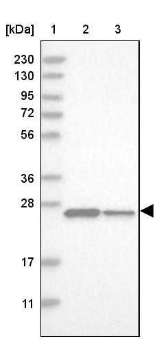 Lane 1: Marker [kDa] 230, 130, 95, 72, 56, 36, 28, 17, 11<br/>Lane 2: Human cell line RT-4<br/>Lane 3: Human cell line U-251MG sp