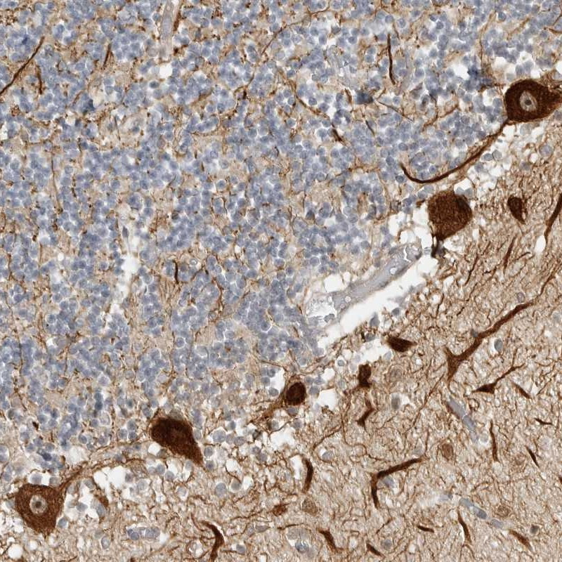 Immunohistochemical staining of human cerebellum shows strong dot like nucleolar and cytoplasmic positivity in purkinje cells.