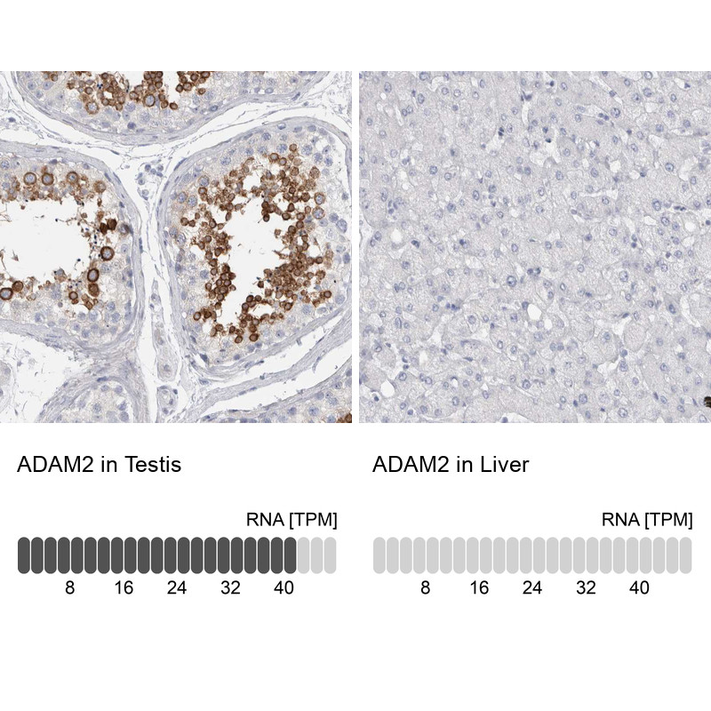 Immunohistochemistry analysis in human testis and liver tissues using HPA024621 antibody. Corresponding ADAM2 RNA-seq data are presented for the same tissues.