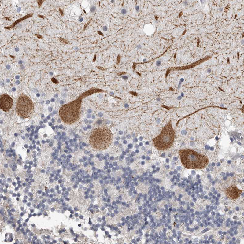 Immunohistochemical staining of human cerebellum shows strong cytoplasmic positivity in Purkinje cells.