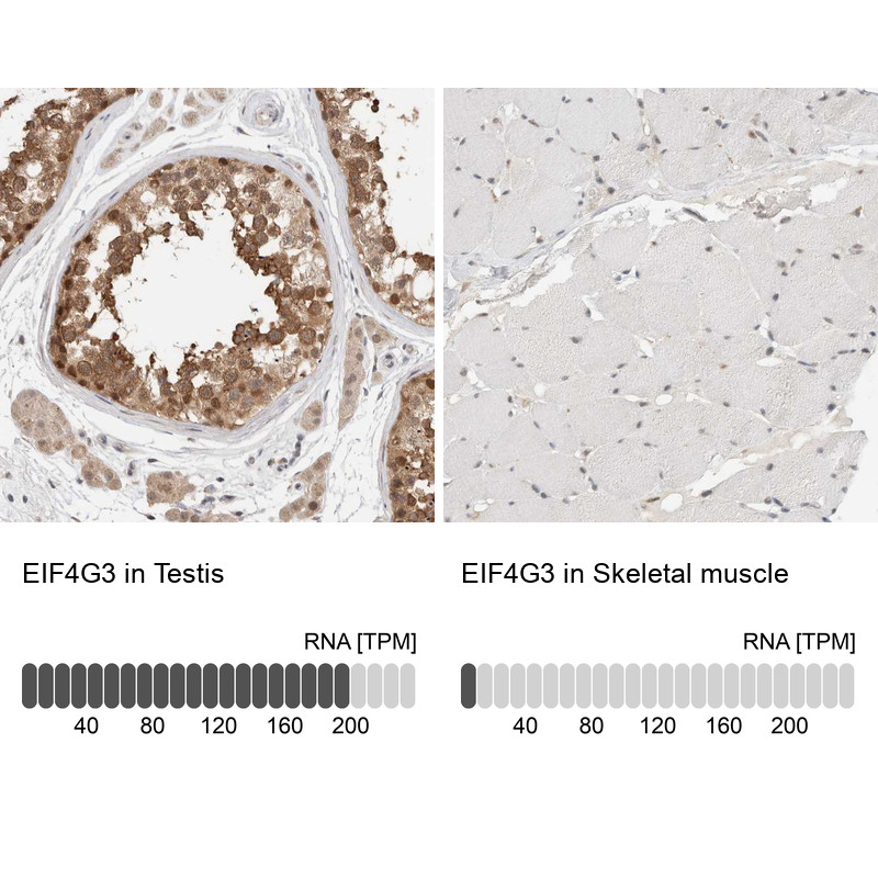 Immunohistochemistry analysis in human testis and skeletal muscle tissues using Anti-EIF4G3 antibody. Corresponding EIF4G3 RNA-seq data are presented for the same tissues.