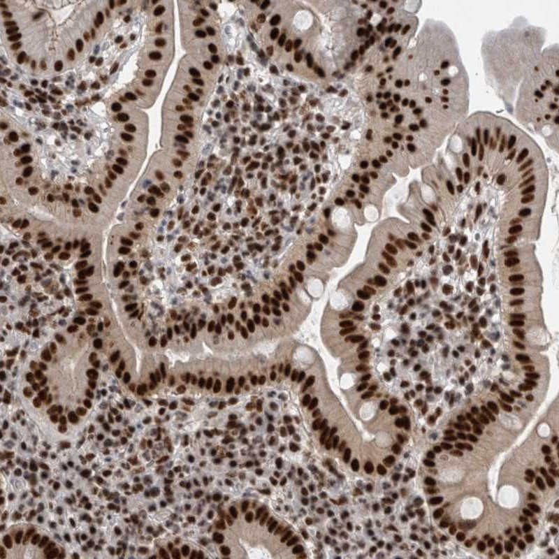 Immunohistochemical staining of human duodenum shows strong nuclear positivity in glandular cells.
