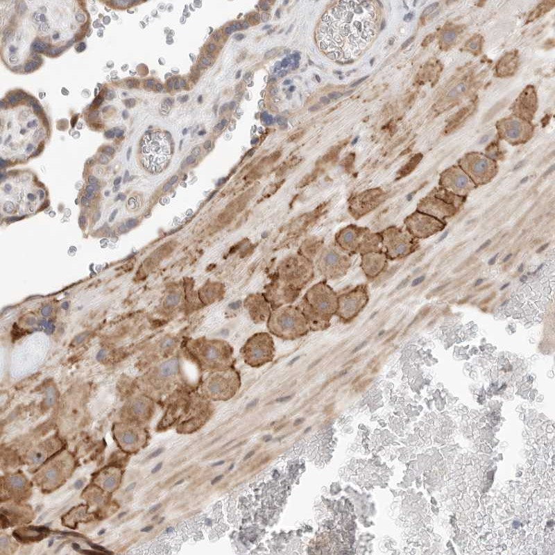 Immunohistochemical staining of human placenta shows strong membranous and cytoplasmic positivity in decidual cells.