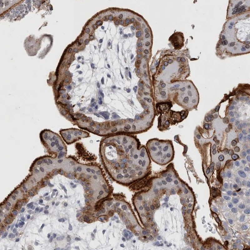 Immunohistochemical staining of human placenta shows strong cytoplasmic positivity in trophoblastic cells.