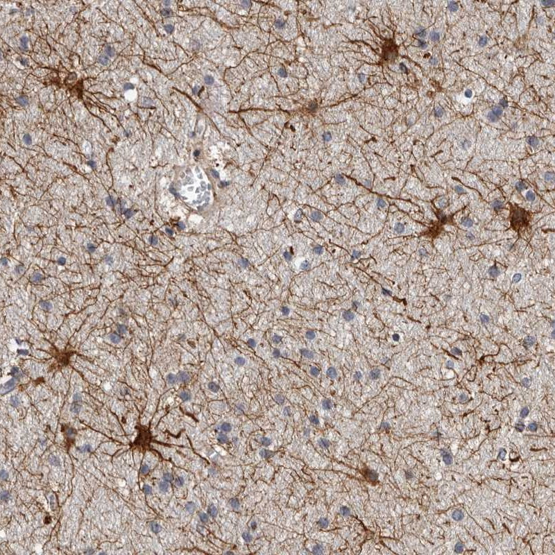 Immunohistochemical staining of human cerebral cortex shows strong cytoplasmic positivity in asterocyte-like cells.