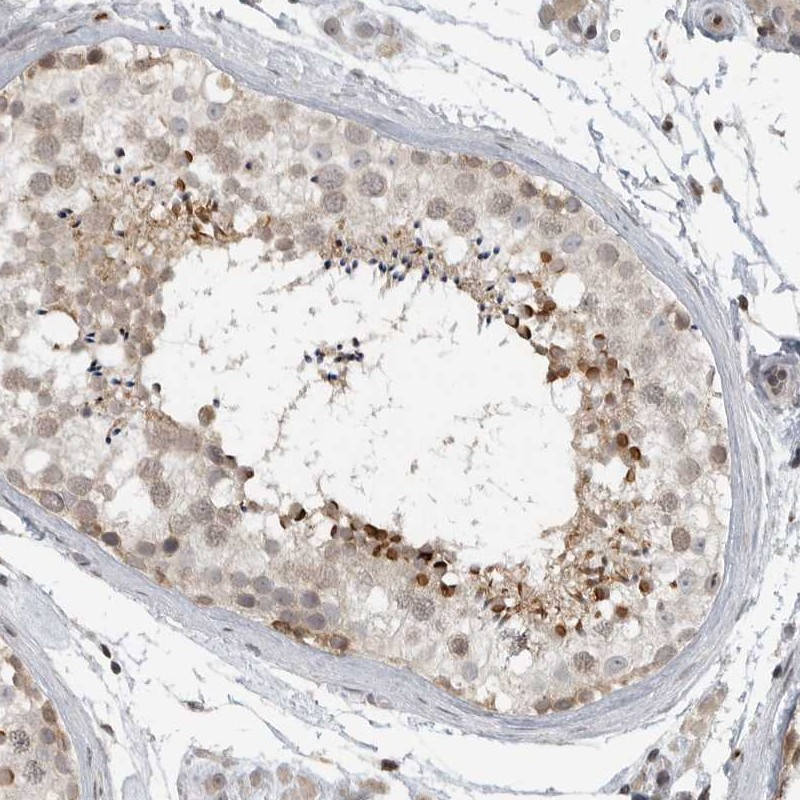 Immunohistochemical staining of human testis shows strong cytoplasmic positivity in subsets of seminiferous duct cells.