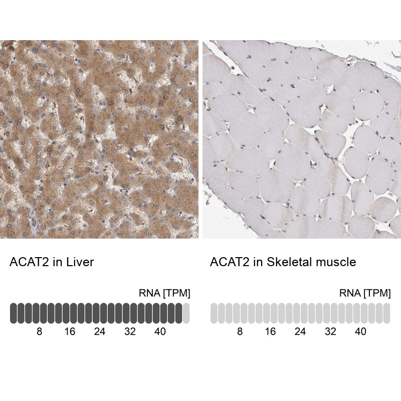 Immunohistochemistry analysis in human liver and skeletal muscle tissues using HPA025736 antibody. Corresponding ACAT2 RNA-seq data are presented for the same tissues.