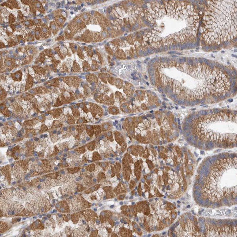 Immunohistochemical staining of human stomach shows moderate cytoplasmic positivity in glandular cells.