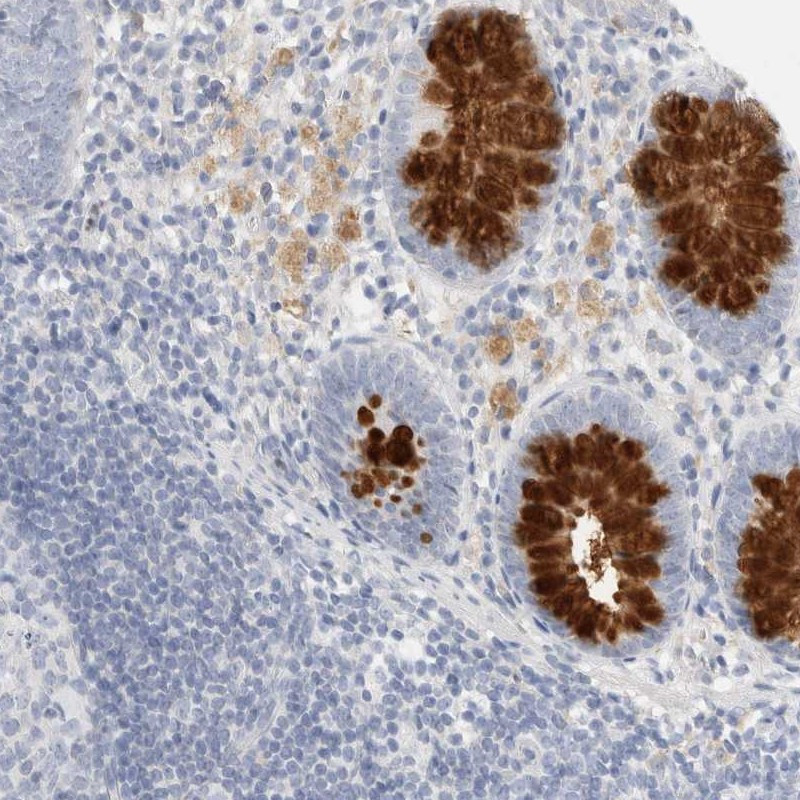 Immunohistochemical staining of human appendix shows distinct positivity of intracellular material in glandular cells.