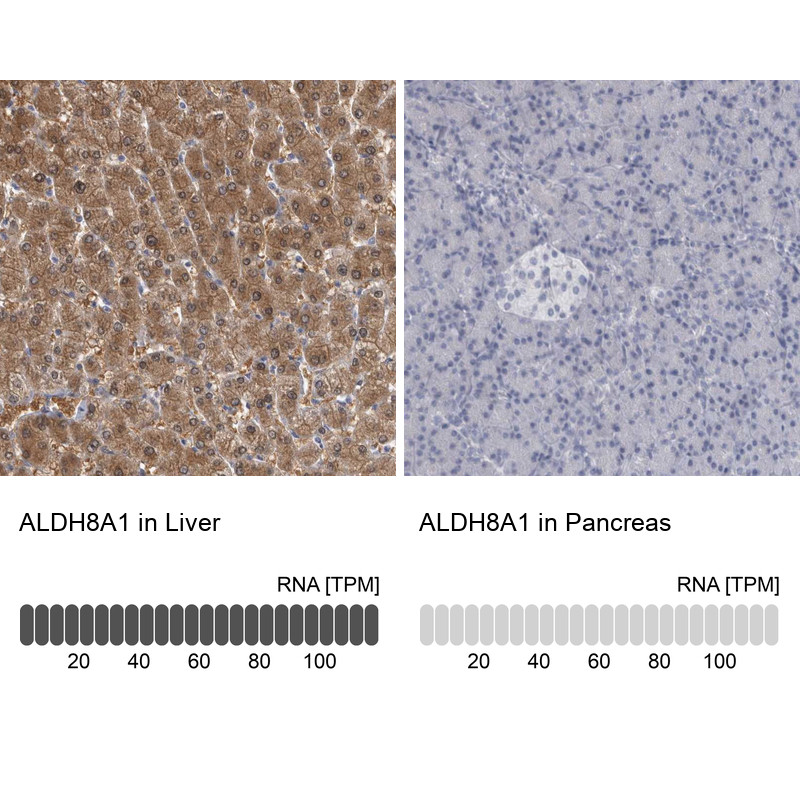 Immunohistochemistry analysis in human liver and pancreas tissues using Anti-ALDH8A1 antibody. Corresponding ALDH8A1 RNA-seq data are presented for the same tissues.