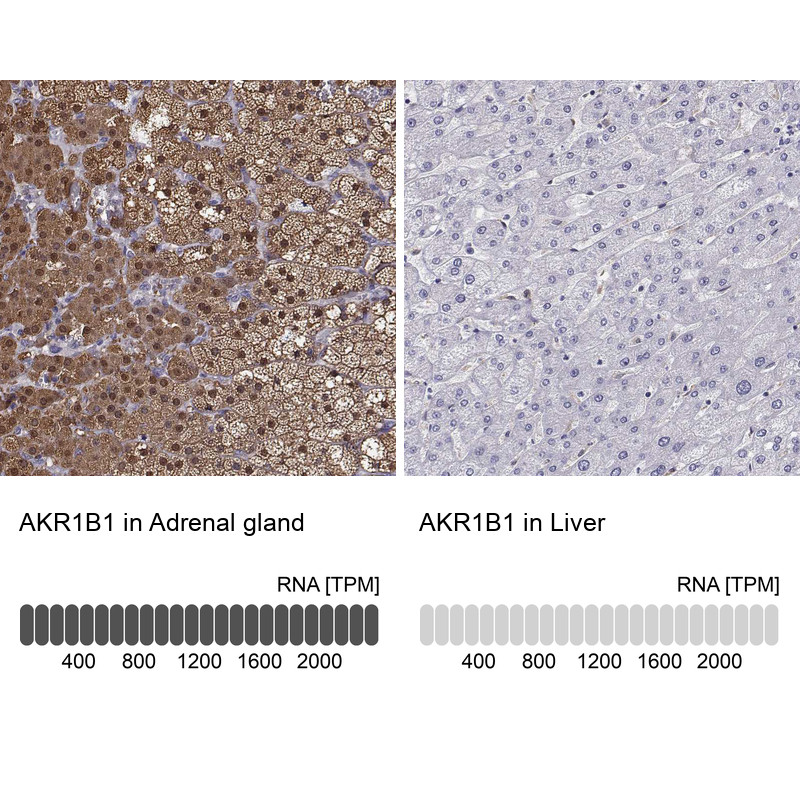 Immunohistochemistry analysis in human adrenal gland and liver tissues using HPA026425 antibody. Corresponding AKR1B1 RNA-seq data are presented for the same tissues.