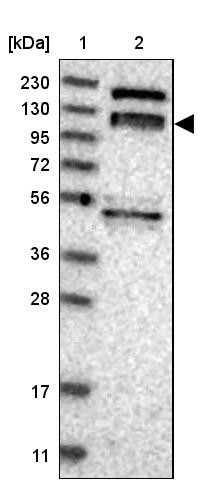 Lane 1: Marker [kDa] 230, 130, 95, 72, 56, 36, 28, 17, 11<br/>Lane 2: Human cell line RT-4