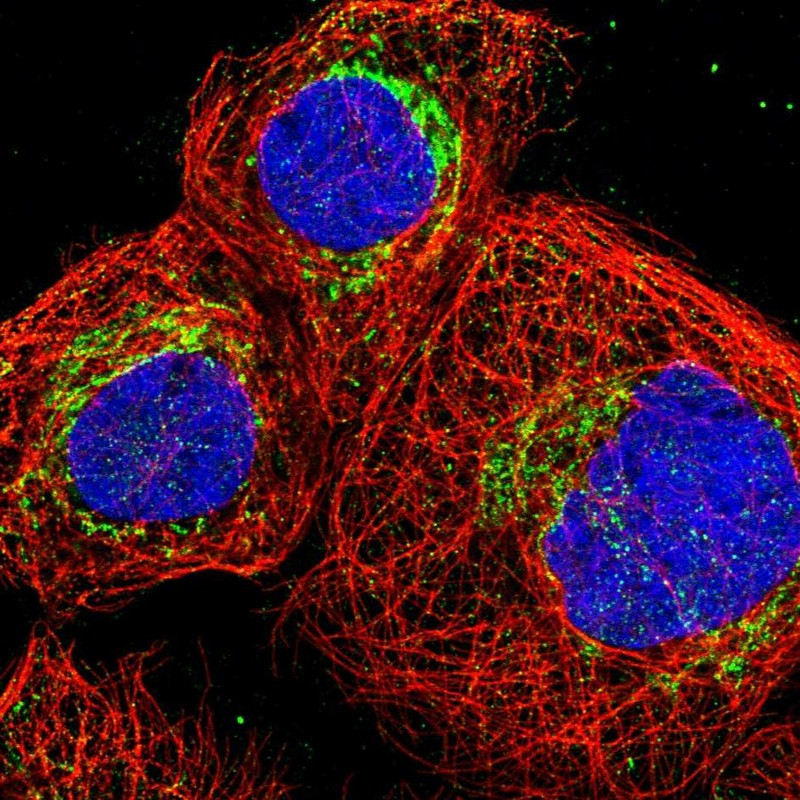 Immunofluorescent staining of human cell line A-431 shows localization to mitochondria.