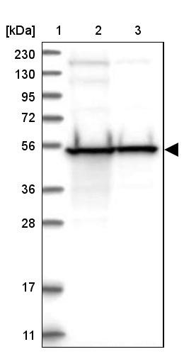 Lane 1: Marker [kDa] 230, 130, 95, 72, 56, 36, 28, 17, 11<br/>Lane 2: Human cell line RT-4<br/>Lane 3: Human cell line U-251MG sp