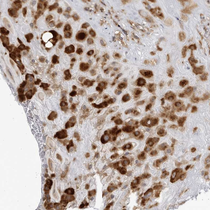 Immunohistochemical staining of human placenta shows strong cytoplasmic positivity in decidual cells.